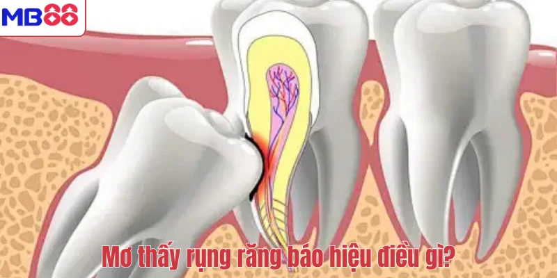 Mơ thấy rụng răng báo hiệu điều gì?